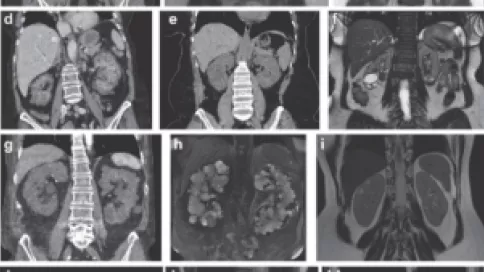 Visuel axe 1 - Representative abdominal imaging of 15 individuals from 12 families